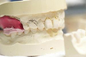 目黒区で人気の有る矯正歯科について