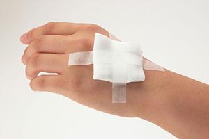 そばかすやシミにはシミレーザー治療がオススメ