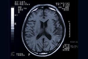 小山市の歯科選びに迷ったらこれ！2025年最新情報と信頼できる歯科医院のポイント